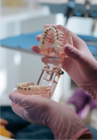 Modello ortodontico esplicativo